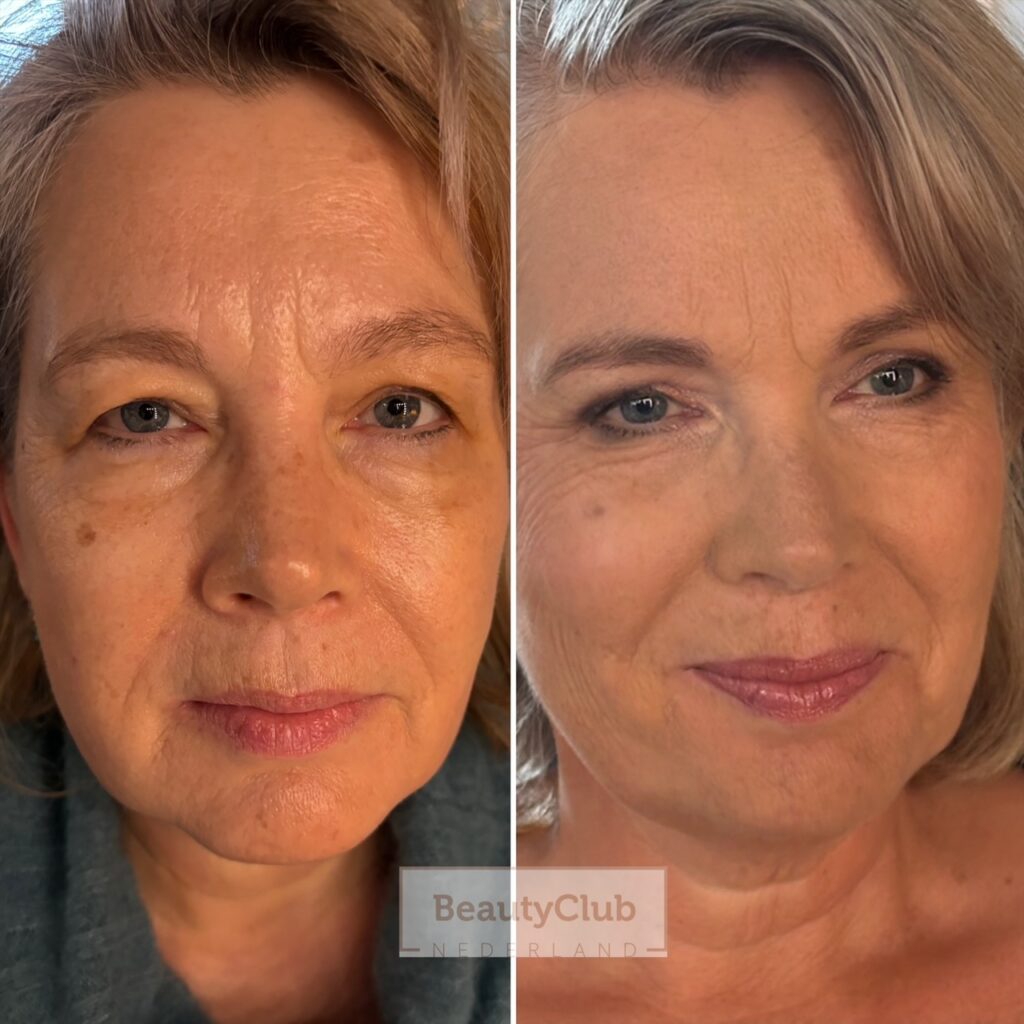 Glow & Reset